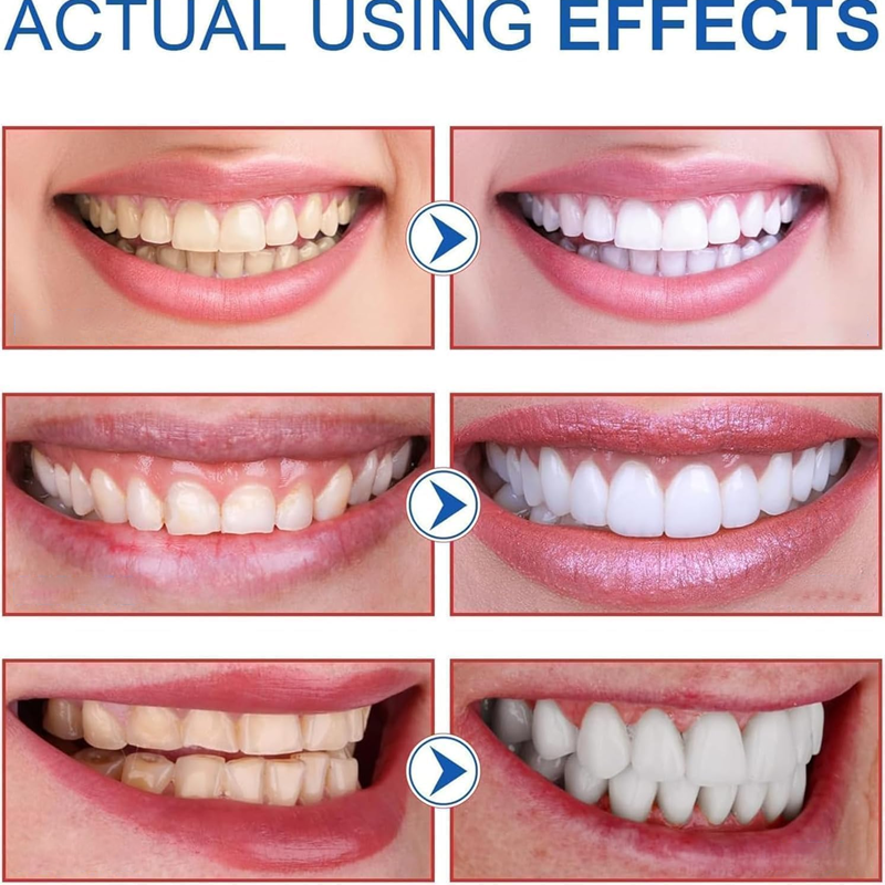 ✨AEXZR® SP-8 Probiotic Whitening Toothpaste | Gentle on gums, no irritation🦷