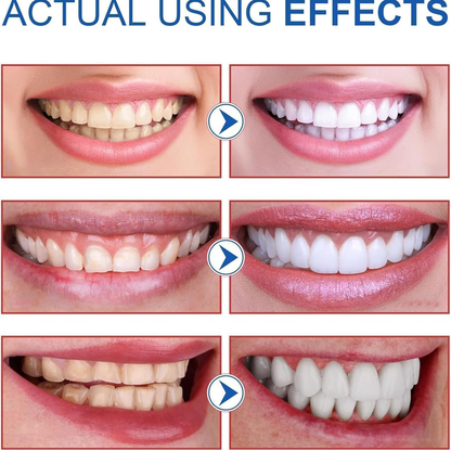 ✨AEXZR® SP-8 Probiotic Whitening Toothpaste | Gentle on gums, no irritation🦷