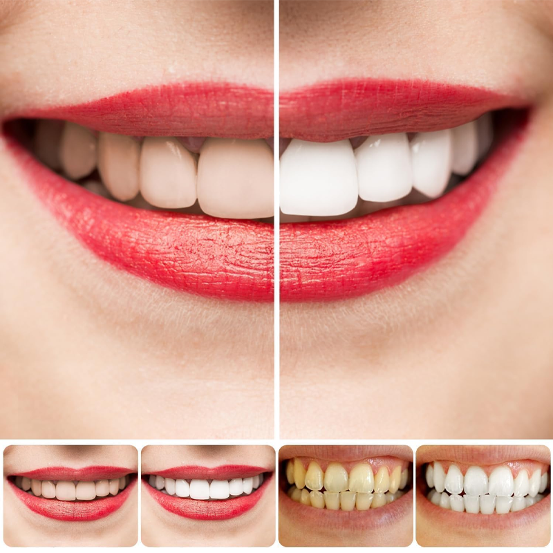 ✨AEXZR® SP-8 Probiotic Whitening Toothpaste | Gentle on gums, no irritation🦷